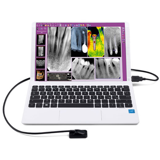 Zen X Intraoral Sensor for real-time images | MyRay | MyRay